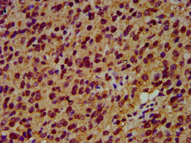 SIAH2 Antibody (PACO58901)