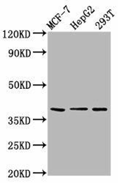 POU5F1B Antibody (PACO59029)