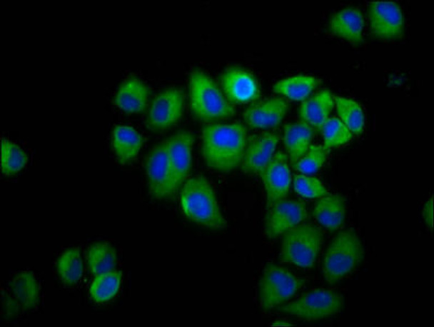 GLRB Antibody (PACO59728)