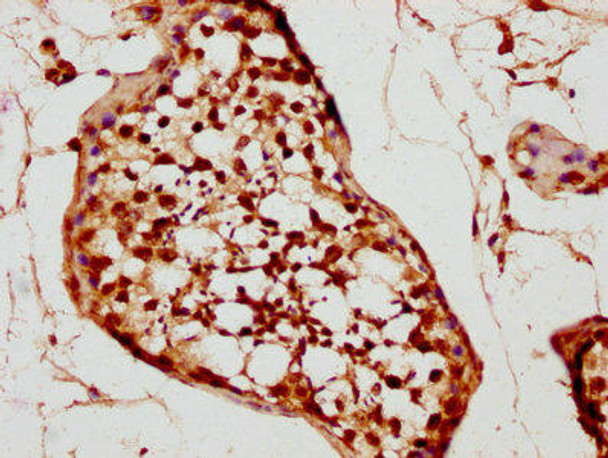 TNP2 Antibody (PACO60853)