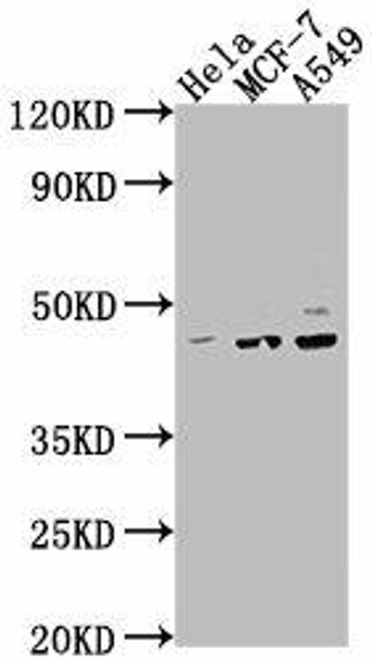 PRKACA Antibody (PACO63375)