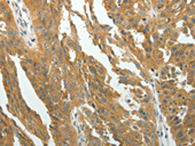RARA Antibody (PACO14953)