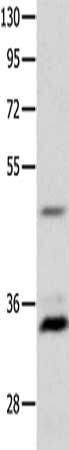 MC1R Antibody (PACO18194)