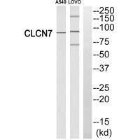 CLCN7 Antibody (PACO22262)