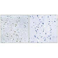 NPHP4 Antibody (PACO22456)