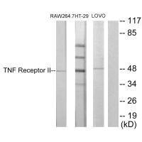TNFRSF1B Antibody (PACO23205)