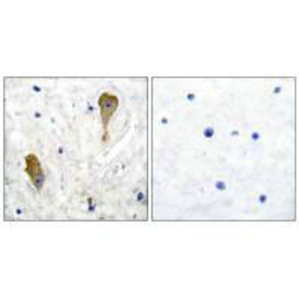 GAD1 Antibody (PACO23660)