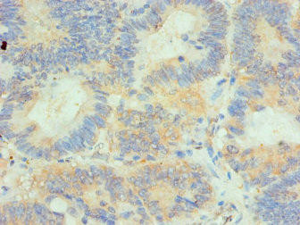 HIP1 Antibody (PACO44130)