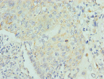 LUM Antibody (PACO44182)