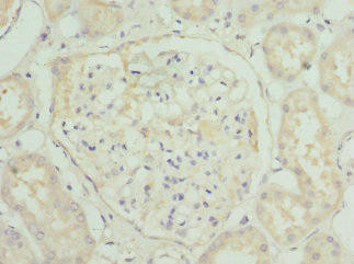 HGD Antibody (PACO44346)