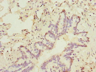 SOX5 Antibody (PACO44470)