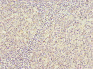 PSMD8 Antibody (PACO44520)