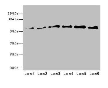 PIP5K1B Antibody (PACO44786)
