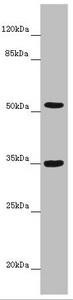 KCNS3 Antibody (PACO45009)