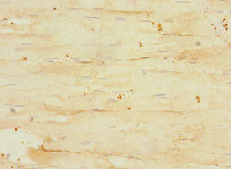 GABRA4 Antibody (PACO45345)