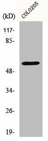 IKZF3 Antibody (PACO00951)