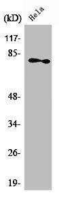 PRKCZ Antibody (PACO01344)