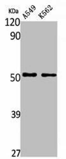 ALDH3A1 Antibody (PACO01744)