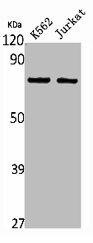 HGFAC Antibody (PACO01788)