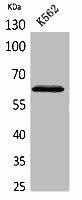 HPSE Antibody (PACO02041)