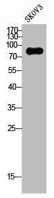 CSF3R Antibody (PACO02195)