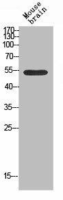 KCNK3 Antibody (PACO07214)