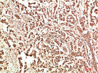 PTK2 Antibody (PACO07308)