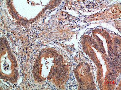 PDGFC Antibody (PACO07374)