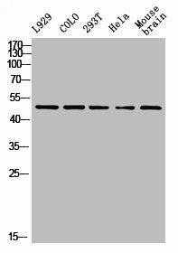 PTEN Antibody (PACO07114)