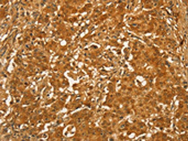 RPL26L1 Antibody (PACO15600)