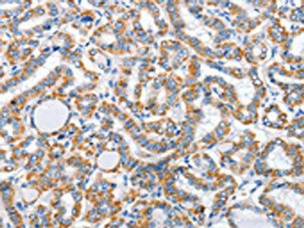 ARL11 Antibody (PACO15823)