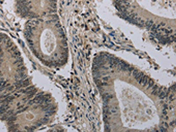 HIST1H2AH Antibody (PACO16461)