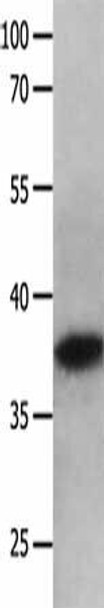 MAPK10 Antibody (PACO18120)