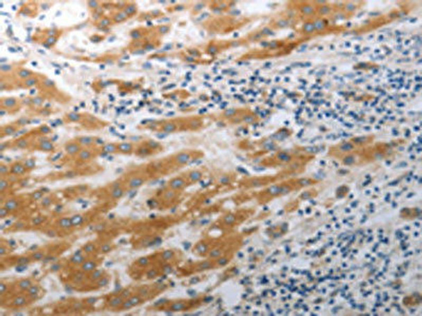 SLC12A6 Antibody (PACO18401)