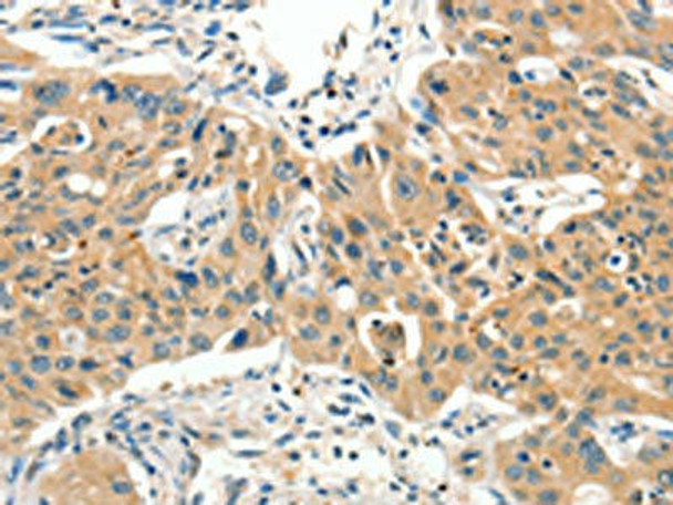 SLC11A2 Antibody (PACO19578)
