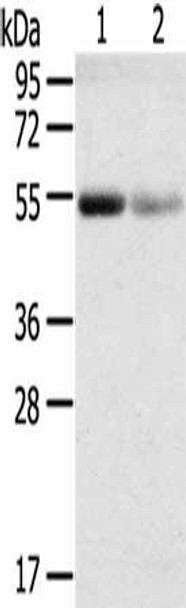 SLC17A1 Antibody (PACO20539)