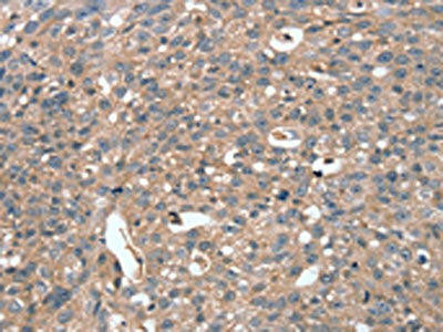 STK36 Antibody (PACO20614)