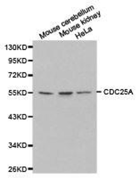 CDC25A Antibody (PACO21093)