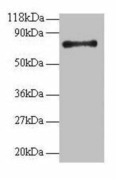 RPS18 Antibody (PACO28730)