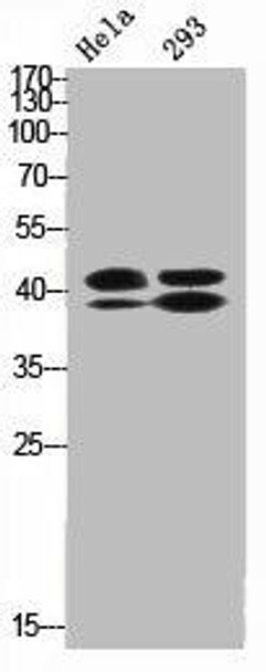 Phospho-MAPK3/MAPK1 (T202/Y204) Antibody (PACO00331)