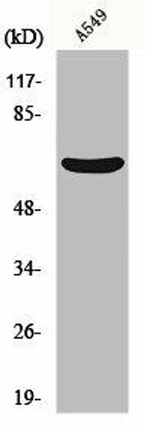 MMP11 Antibody (PACO01073)