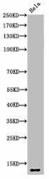 Acetyl-Histone H4 (K5) Antibody (PACO06050)