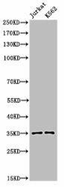 Acetyl-APEX1 (K7) Antibody (PACO06055)