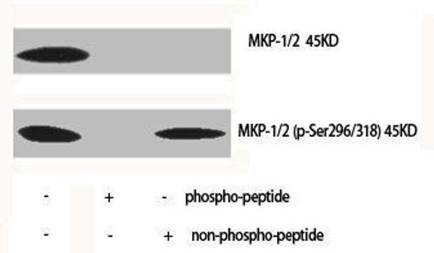 Phospho-DUSP1/DUSP4 (S296/318) Antibody (PACO06189)