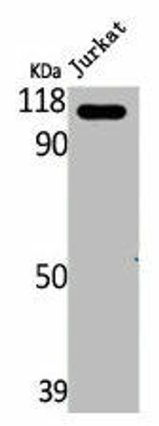 MAP3K13 Antibody (PACO06621)