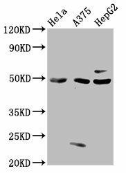STK24 Antibody (PACO25192)