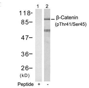 Phospho-CTNNB1 (Thr41/Ser45) Antibody (PACO23855)