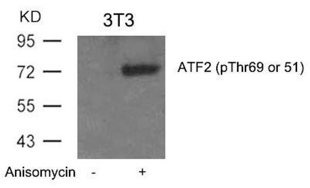 Phospho-ATF2 (Thr69 or 51) Antibody (PACO24444)