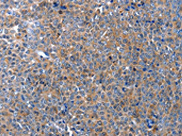 APAF1 Antibody (PACO17536)