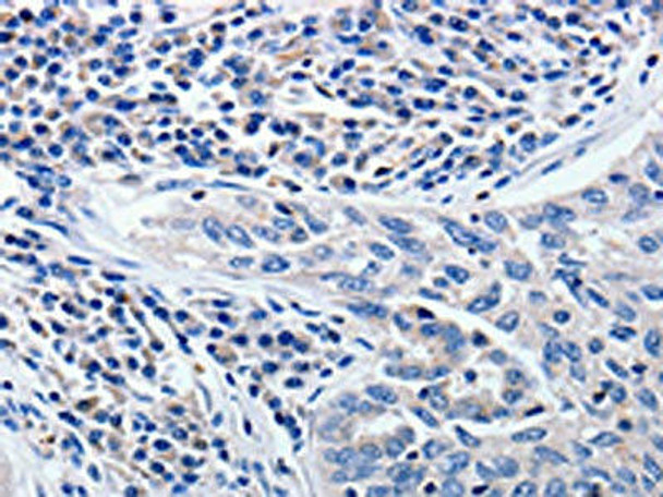 CCNE1 Antibody (PACO17767)